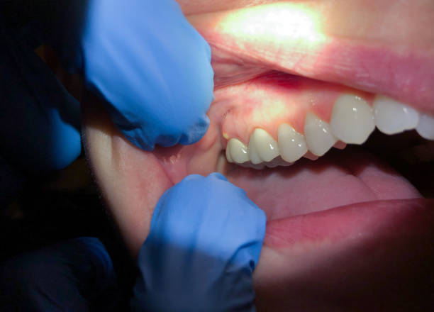 Best Emergency Cosmetic Dentistry in Bellevle, IL