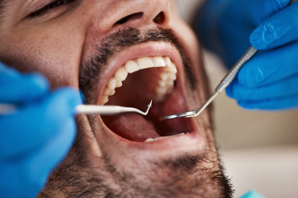 Best Holiday Emergency Dentist in Bellevle, IL