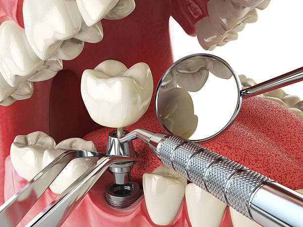 Best Orthodontic Emergency Dentist in Bellevle, IL